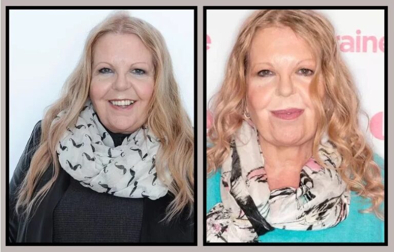sally thomsett face illness